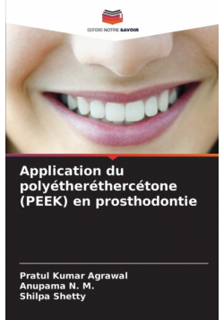 Application du polyétheréthercétone (PEEK) en prosthodontie