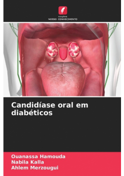 Candidíase oral em diabéticos