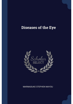 Diseases of the Eye