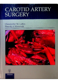Carotid Artery Surgery