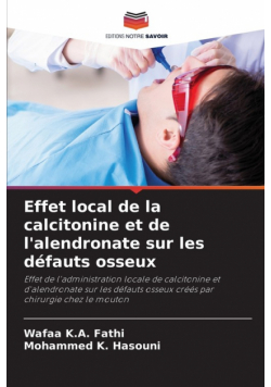 Effet local de la calcitonine et de l'alendronate sur les défauts osseux