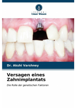Versagen eines Zahnimplantats