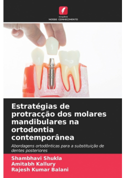 Estratégias de protracção dos molares mandibulares na ortodontia contemporânea