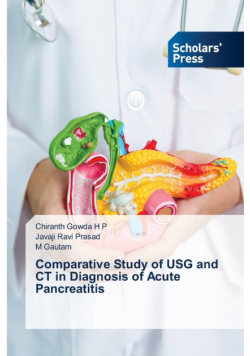 Comparative Study of USG and CT in Diagnosis of Acute Pancreatitis