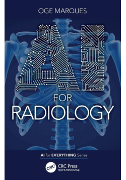 AI for Radiology