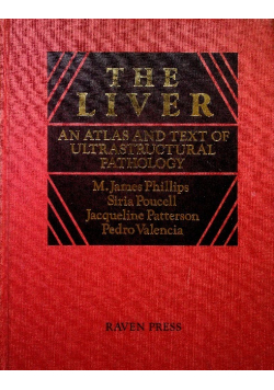 The liver An atlas and text of ultrastructural pathology