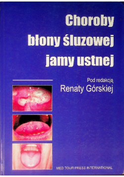 Choroby błony śluzowej jamy ustnej