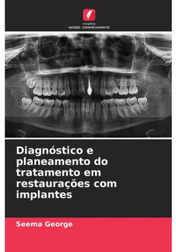 Diagnóstico e planeamento do tratamento em restaurações com implantes