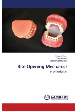 Bite Opening Mechanics