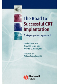 Successful CRT Implantation