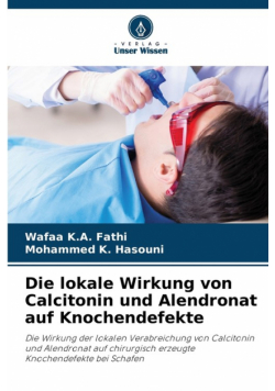 Die lokale Wirkung von Calcitonin und Alendronat auf Knochendefekte