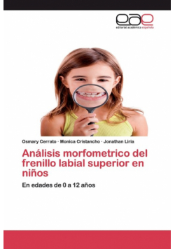 Análisis morfometrico del frenillo labial superior en niños