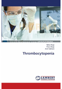 Thrombocytopenia