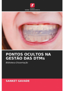 Pontos Ocultos Na Gestão Das Dtms