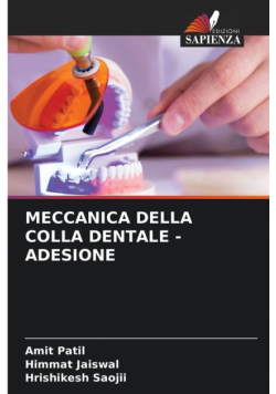 Meccanica Della Colla Dentale - Adesione