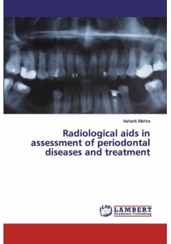 Radiological aids in assessment of periodontal diseases and treatment