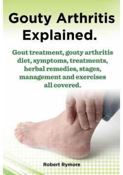 Gouty Arthritis Explained. Gout Treatment, Gouty Arthritis Diet, Symptoms, Treatments, Herbal Remedies, Stages, Management and Exercises All Covered.