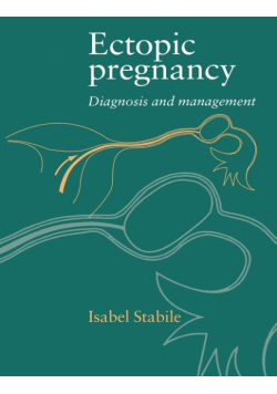 Ectopic Pregnancy