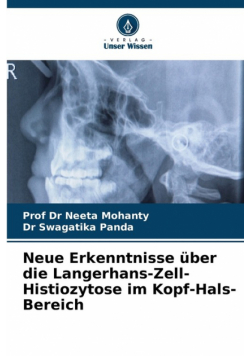 Neue Erkenntnisse über die Langerhans-Zell-Histiozytose im Kopf-Hals-Bereich