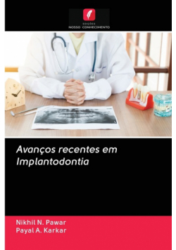Avanços recentes em Implantodontia