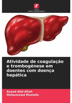 Atividade de coagulação e trombogénese em doentes com doença hepática