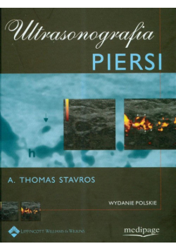 Ultrasonografia piersi