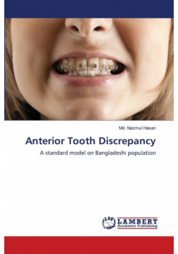 Anterior Tooth Discrepancy