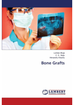 Bone Grafts
