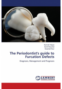The Periodontist's guide to Furcation Defects
