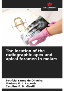 The location of the radiographic apex and apical foramen in molars