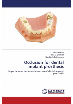 Occlusion for Dental Implant Prosthesis
