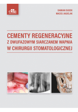 Cementy regeneracyjne z dwufazowym siarczanem wapnia w chirurgii stomatologicznej