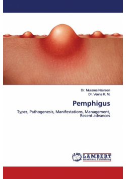 Pemphigus