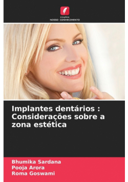 Implantes dentários