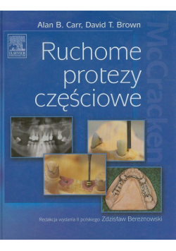 Ruchome protezy częściowe