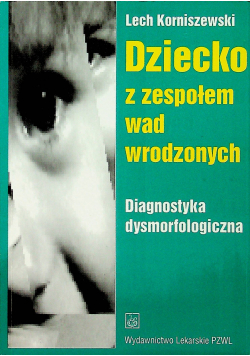 Dziecko z zespołem was wrodzonych