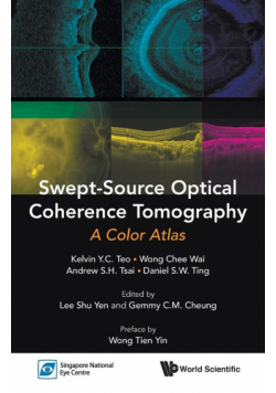 Swept-Source Optical Coherence Tomography