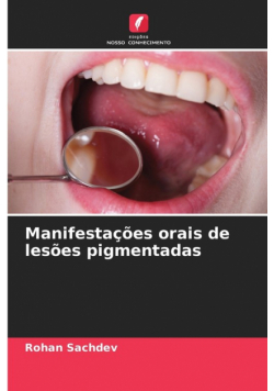 Manifestações orais de lesões pigmentadas