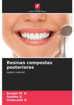 Resinas compostas posteriores