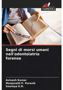 Segni di morsi umani nell'odontoiatria forense