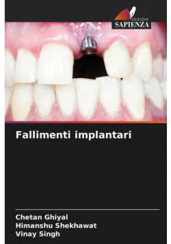 Fallimenti implantari