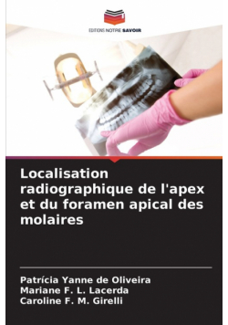 Localisation radiographique de l'apex et du foramen apical des molaires