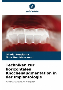 Techniken zur horizontalen Knochenaugmentation in der Implantologie