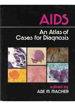 AIDS An Atlas of Cases for Diagnosis