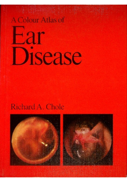 A Colour Atlas of Ear Disease
