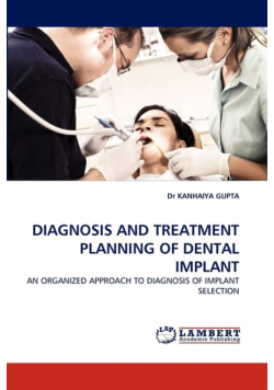 Diagnosis and Treatment Planning of Dental Implant
