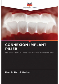 Connexion Implant-Pilier