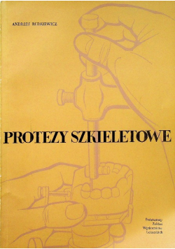 Protezy szkieletowe