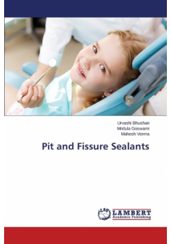 Pit and Fissure Sealants