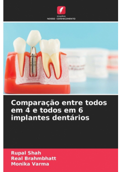Comparação entre todos em 4 e todos em 6 implantes dentários